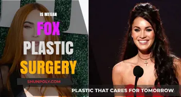 Megan Fox's Transformation: Plastic Surgery Rumors and Realities Explored
