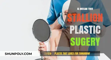 Megan Thee Stallion: Natural Beauty or Plastic Surgery?