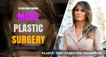 Melania's Evolving Look: More Plastic Surgery Rumors Explored