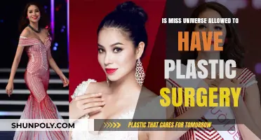 Can Miss Universe Undergo Plastic Surgery? Rules and Realities Explained