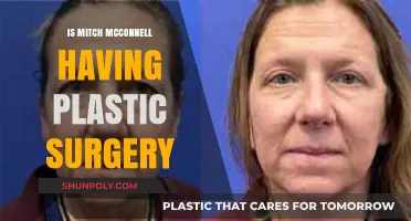 Mitch McConnell's Appearance: Plastic Surgery Speculations and Public Reactions