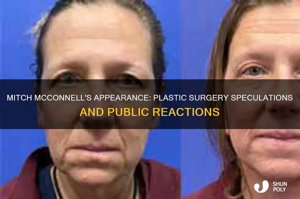 is mitch mcconnell having plastic surgery