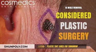 Is Mole Removal Plastic Surgery? Understanding the Procedure and Classification