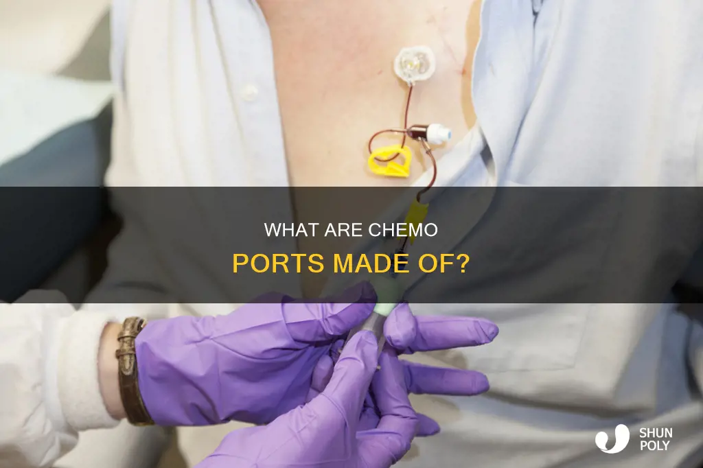 is my chemo port plastic or metal