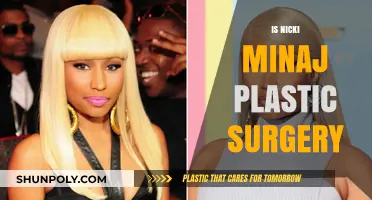Nicki Minaj's Transformation: Unveiling the Truth About Her Plastic Surgery