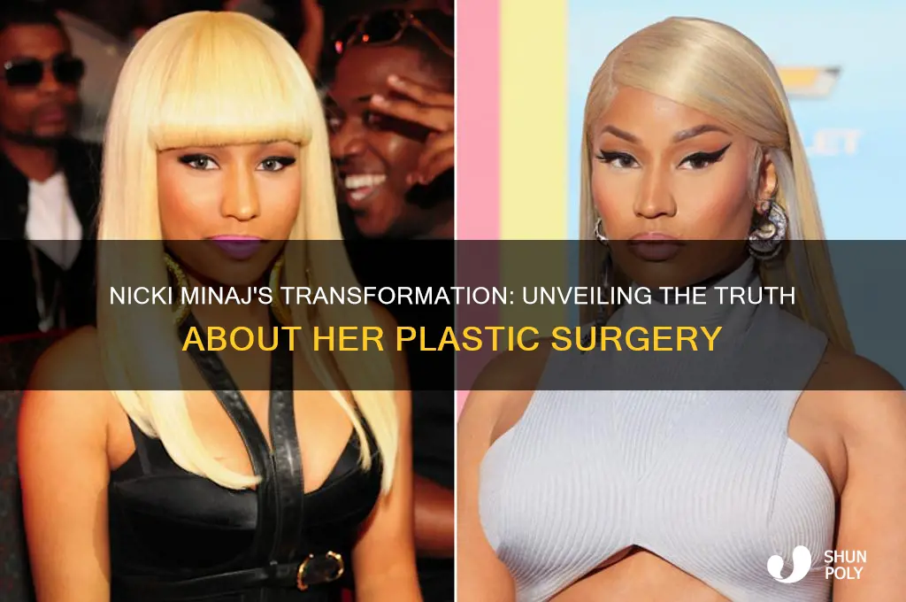 is nicki minaj plastic surgery