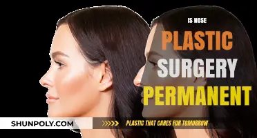 Is Nose Plastic Surgery Permanent? Longevity and Factors Explained