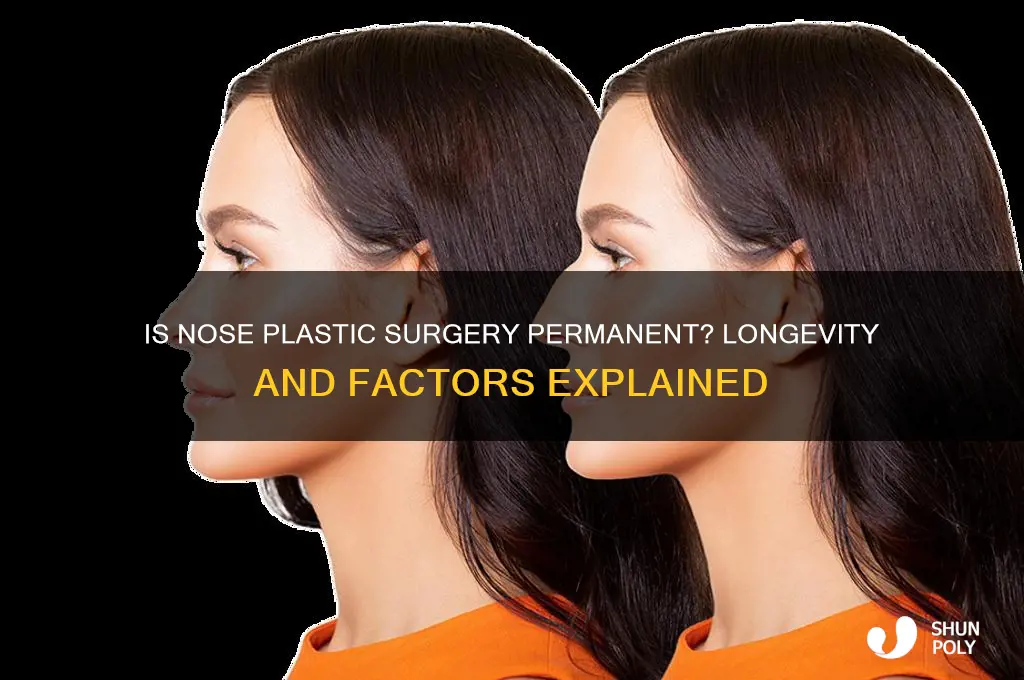 is nose plastic surgery permanent