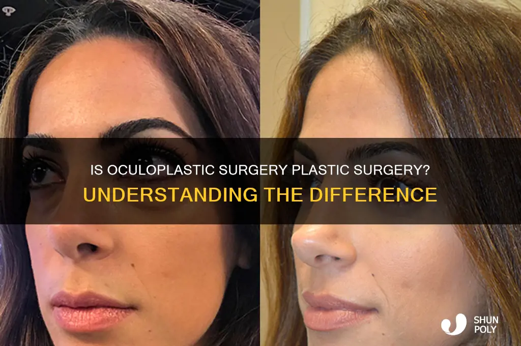 is oculoplastic surgery considered plastic surgery