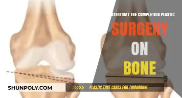 Osteotomy: The Ultimate Bone Reshaping Procedure in Plastic Surgery?