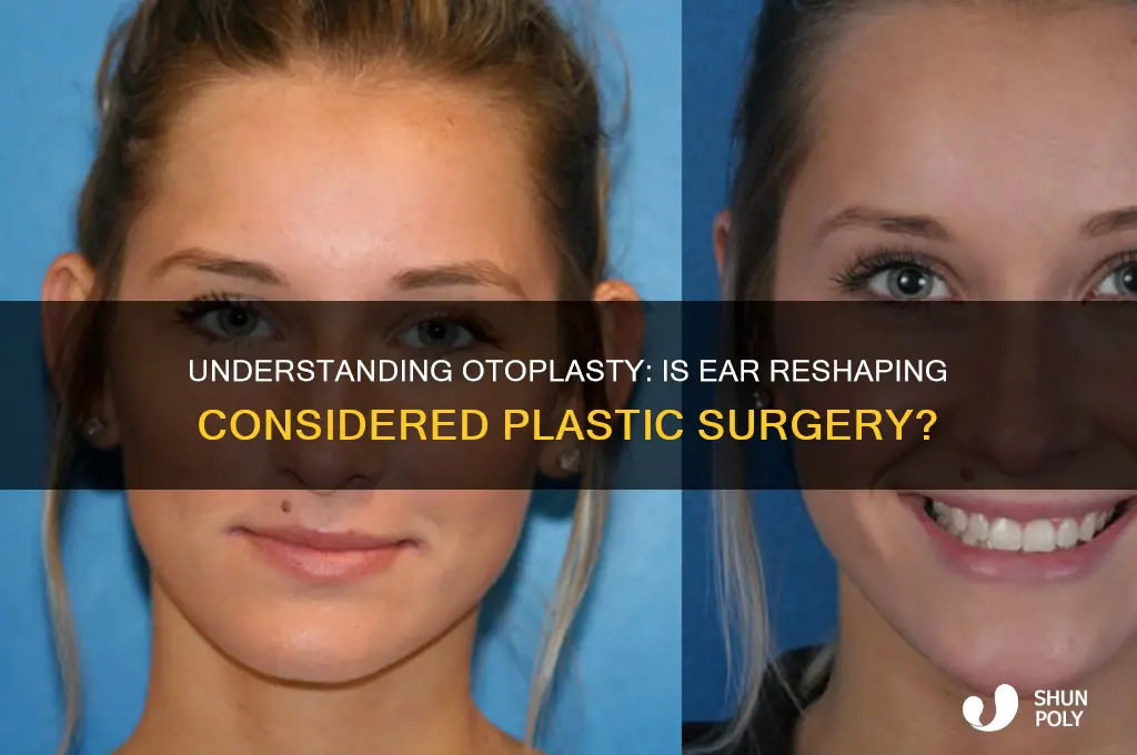 is otoplasty plastic surgery