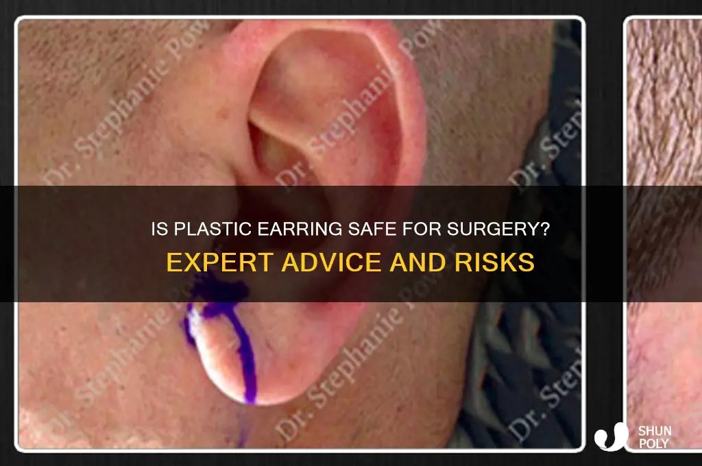 is plastic earring ok for surgery