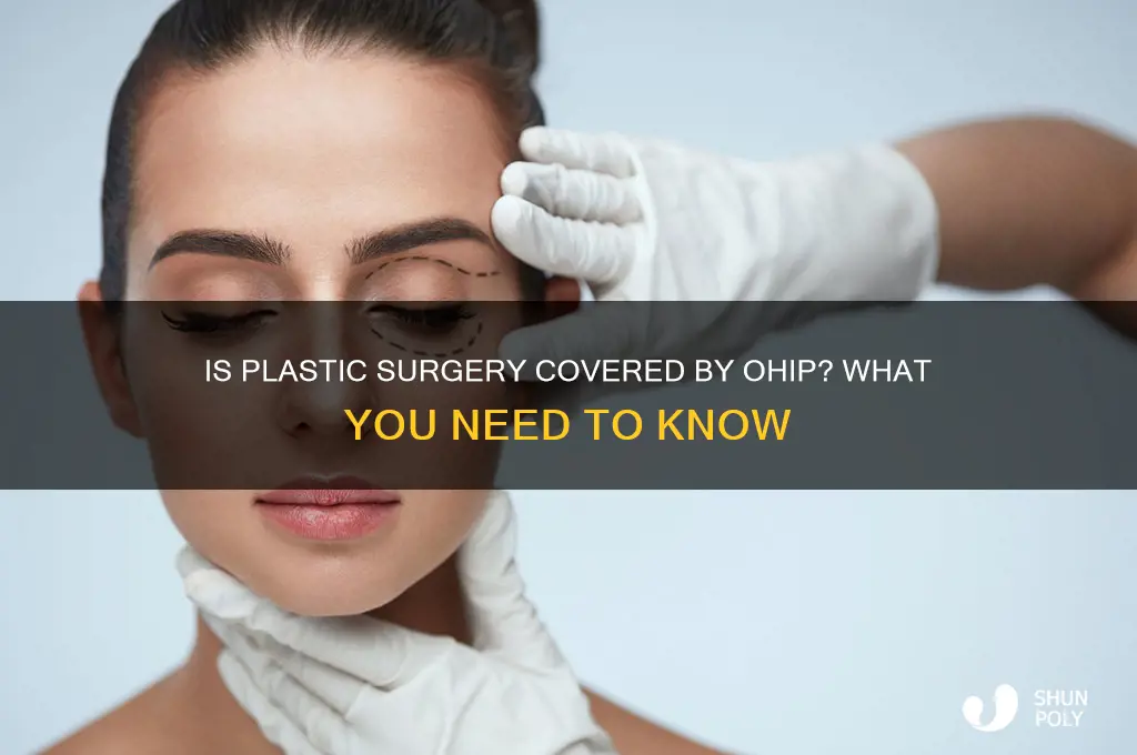 is plastic surgeon covered by ohip