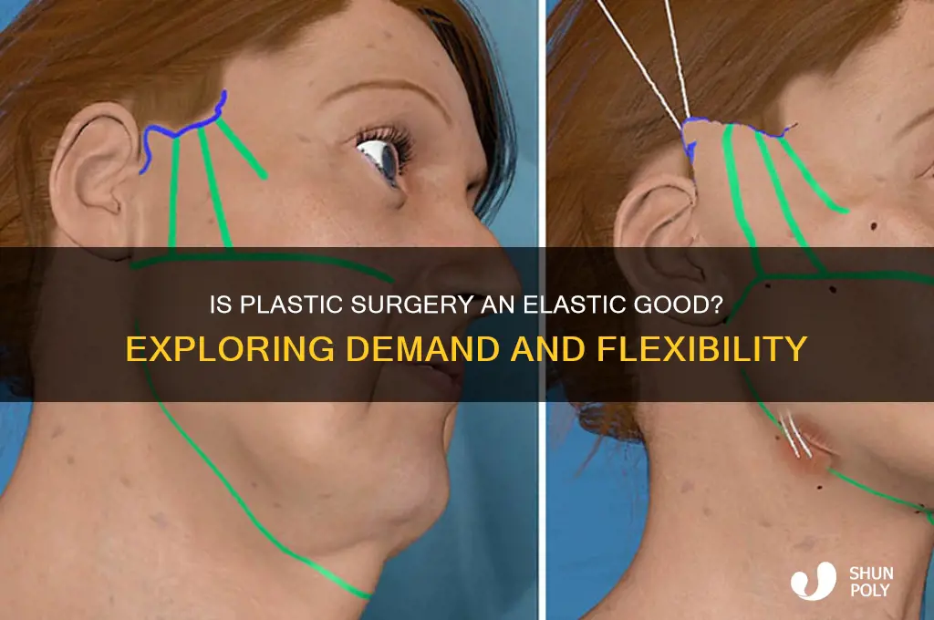 is plastic surgery a elastic goods