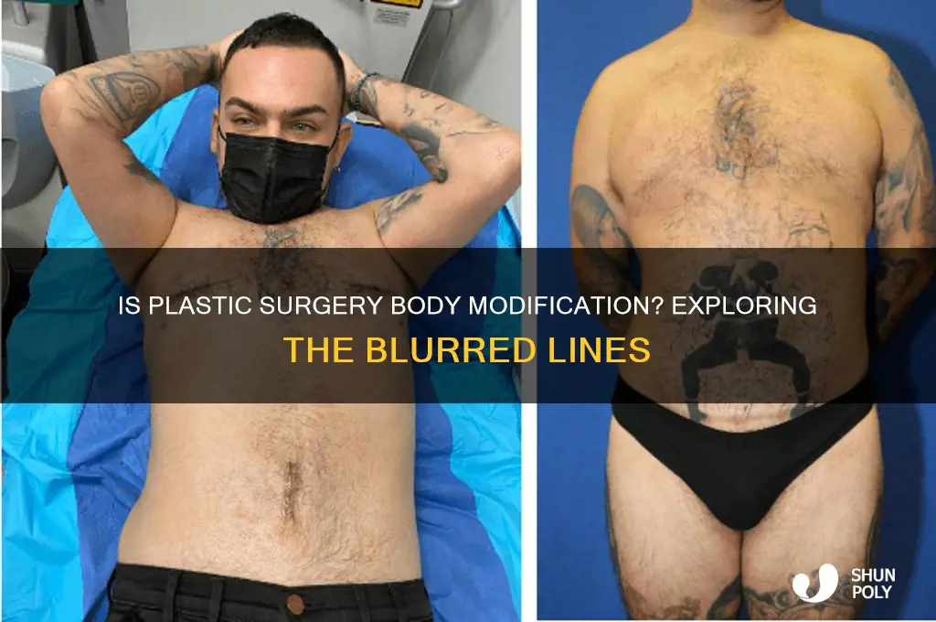 is plastic surgery a form of body modification