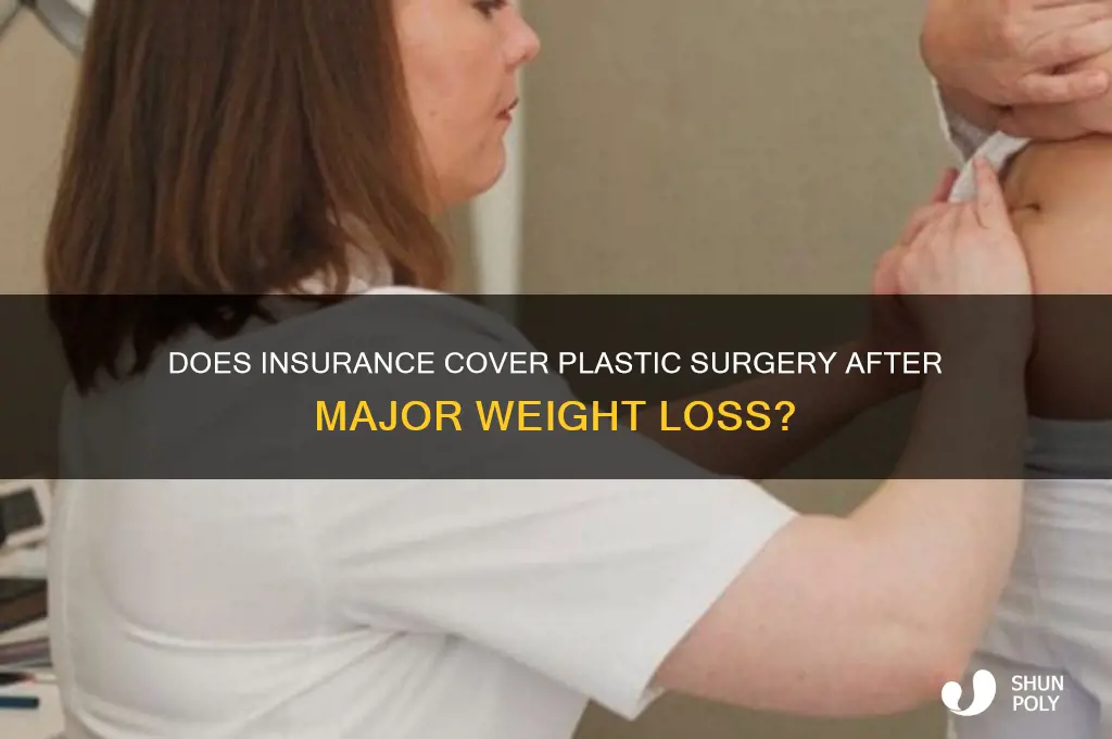 is plastic surgery after weight loss covered by insurance