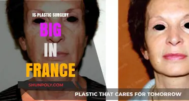 Exploring France's Fascination with Plastic Surgery: Trends and Insights
