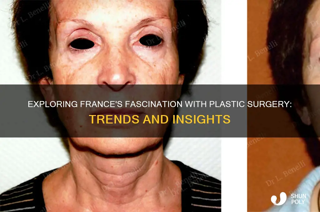 is plastic surgery big in france