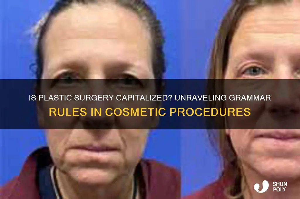 is plastic surgery capitalized