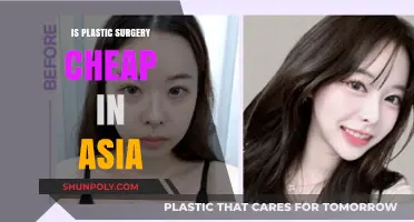 Is Plastic Surgery Affordable in Asia? Exploring Costs and Trends