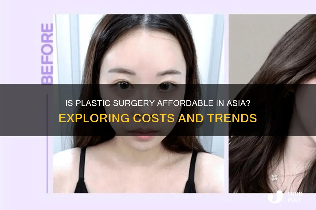 is plastic surgery cheap in asia