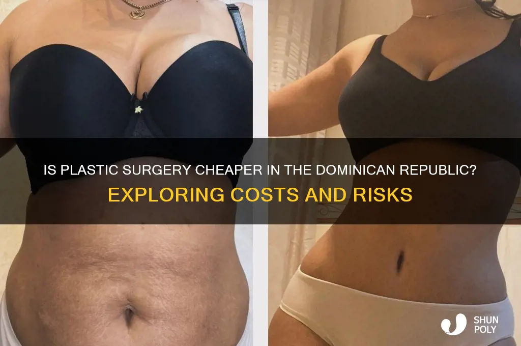 is plastic surgery cheaper in dominican republic
