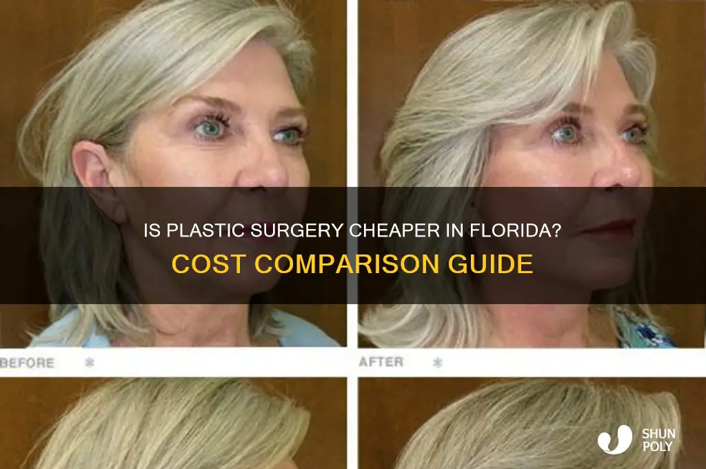 is plastic surgery cheaper in florida