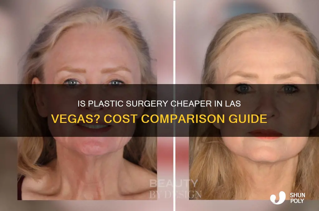is plastic surgery cheaper in las vegas