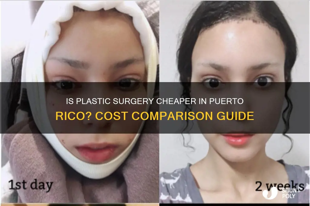 is plastic surgery cheaper in puerto rico