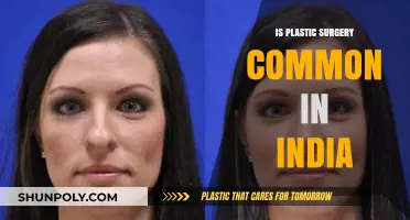 Is Plastic Surgery Common in India? Trends and Insights