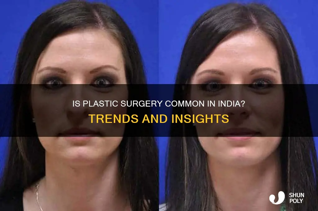 is plastic surgery common in india