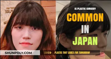 Plastic Surgery Trends in Japan: How Common Are Cosmetic Procedures?