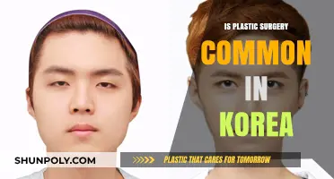 Is Plastic Surgery Common in Korea? Unveiling the Beauty Trends