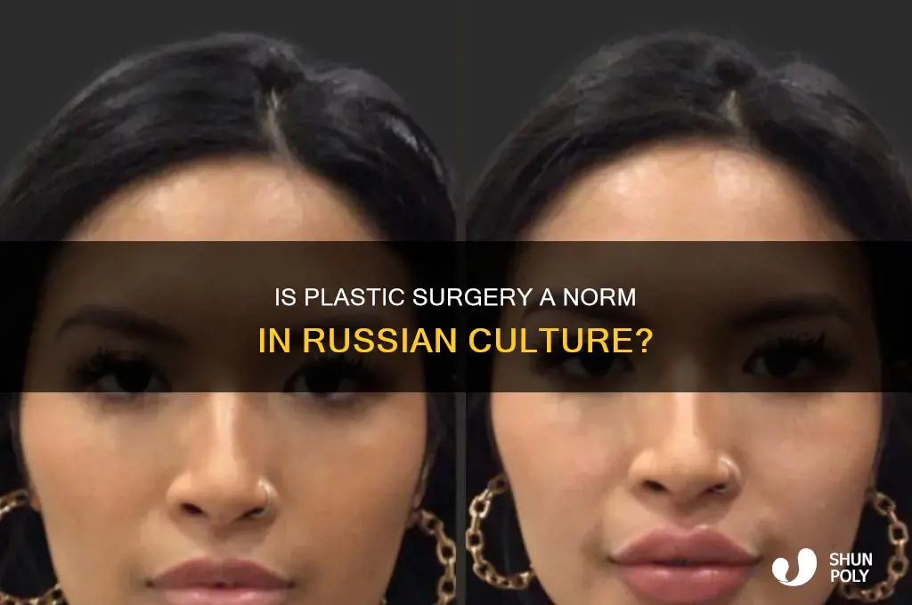 is plastic surgery common in russia