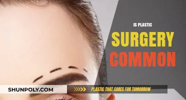 Is Plastic Surgery Common? Exploring Trends and Societal Acceptance