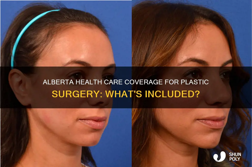 is plastic surgery covered by alberta health care
