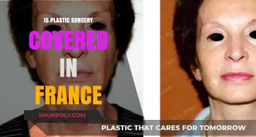 Is Plastic Surgery Covered in France? Understanding Healthcare Policies