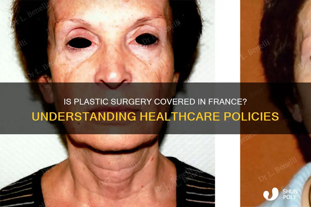 is plastic surgery covered in france