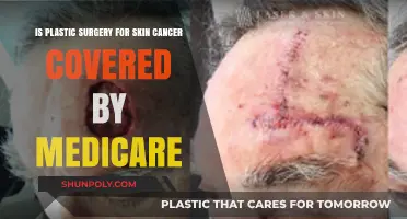 Medicare Coverage for Skin Cancer Plastic Surgery: What's Included?
