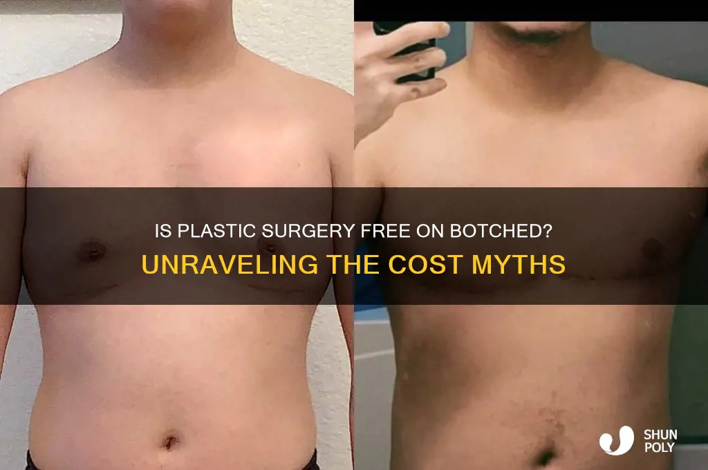 is plastic surgery free on botched