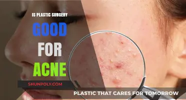 Plastic Surgery for Acne: Benefits, Risks, and Alternatives Explored