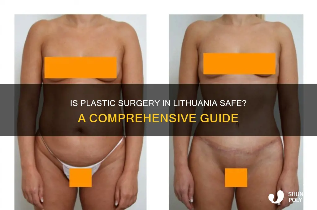 is plastic surgery in lithuania safe