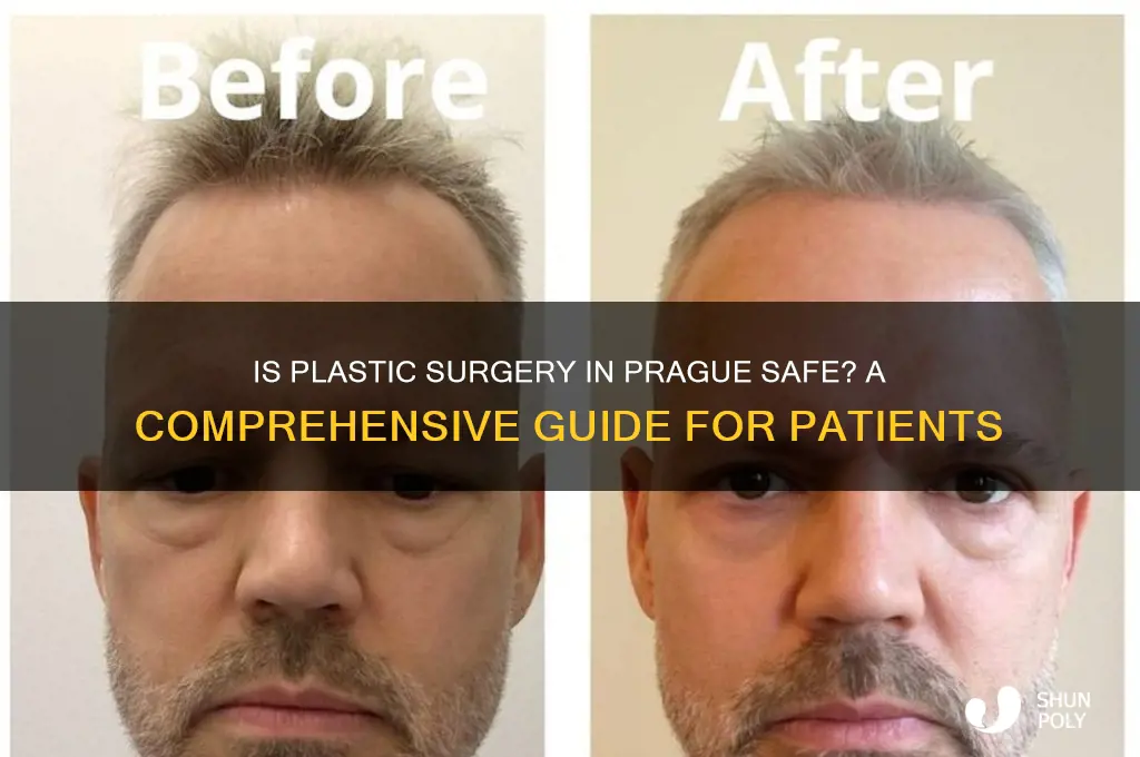 is plastic surgery in prague safe