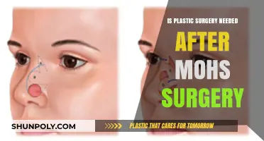 Is Plastic Surgery Necessary After Mohs Surgery? Expert Insights