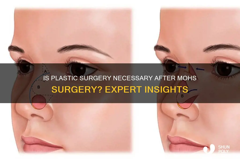 is plastic surgery needed after mohs surgery