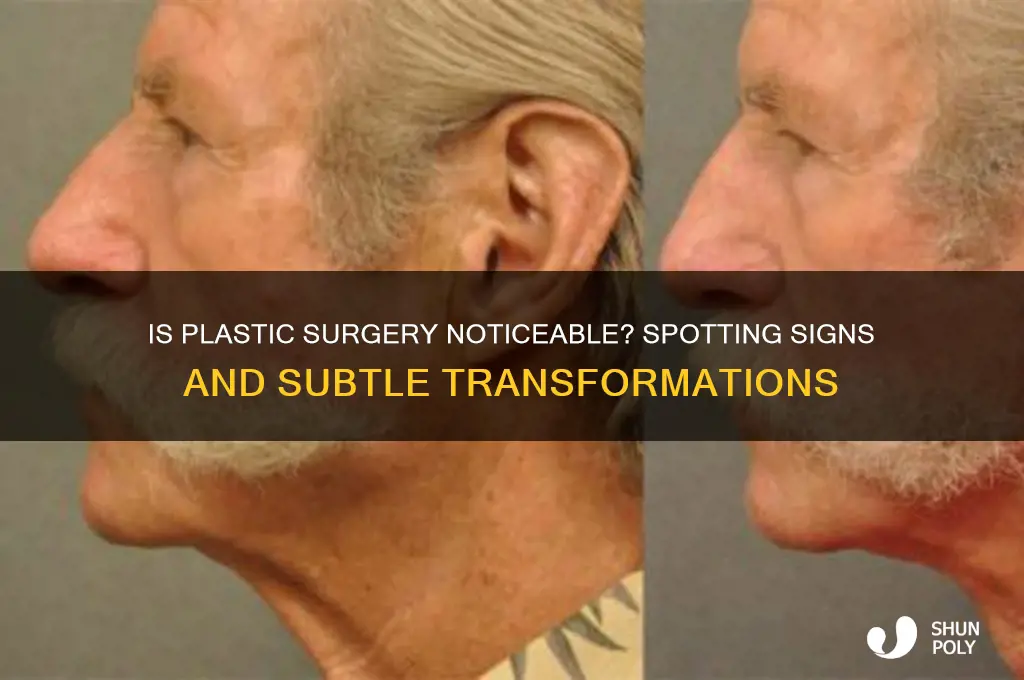 is plastic surgery noticeable