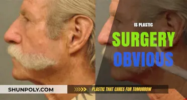Is Plastic Surgery Obvious? Spotting Signs and Understanding Trends