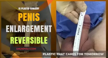 Can Penis Enlargement Surgery Be Reversed? Exploring Plastic Surgery Options