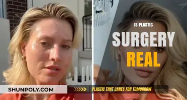 Is Plastic Surgery Real? Debunking Myths and Unveiling the Truth