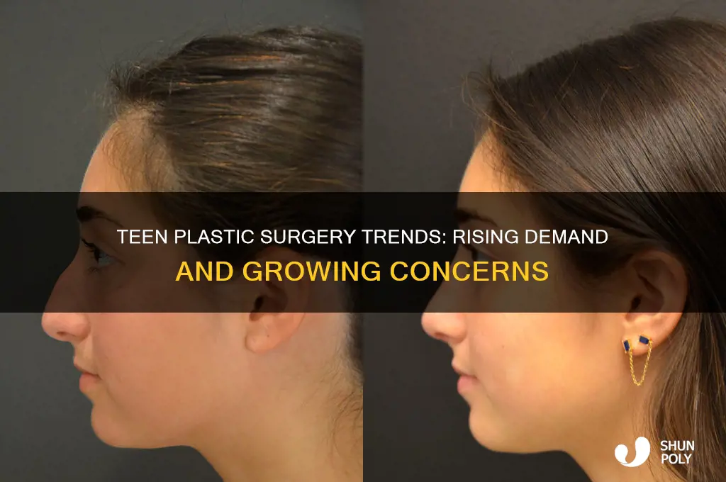 is plastic surgery rising in teens